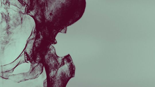 Capítulo 7. Sarcoma vs. Ciencia