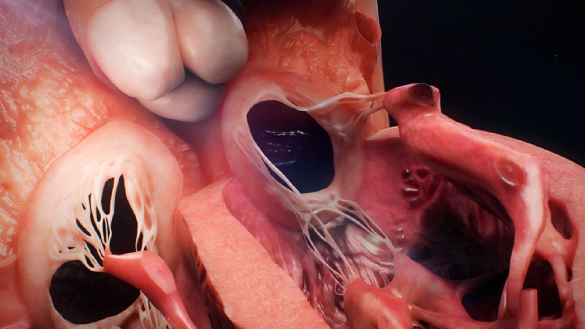 Cuando fallan las válvulas